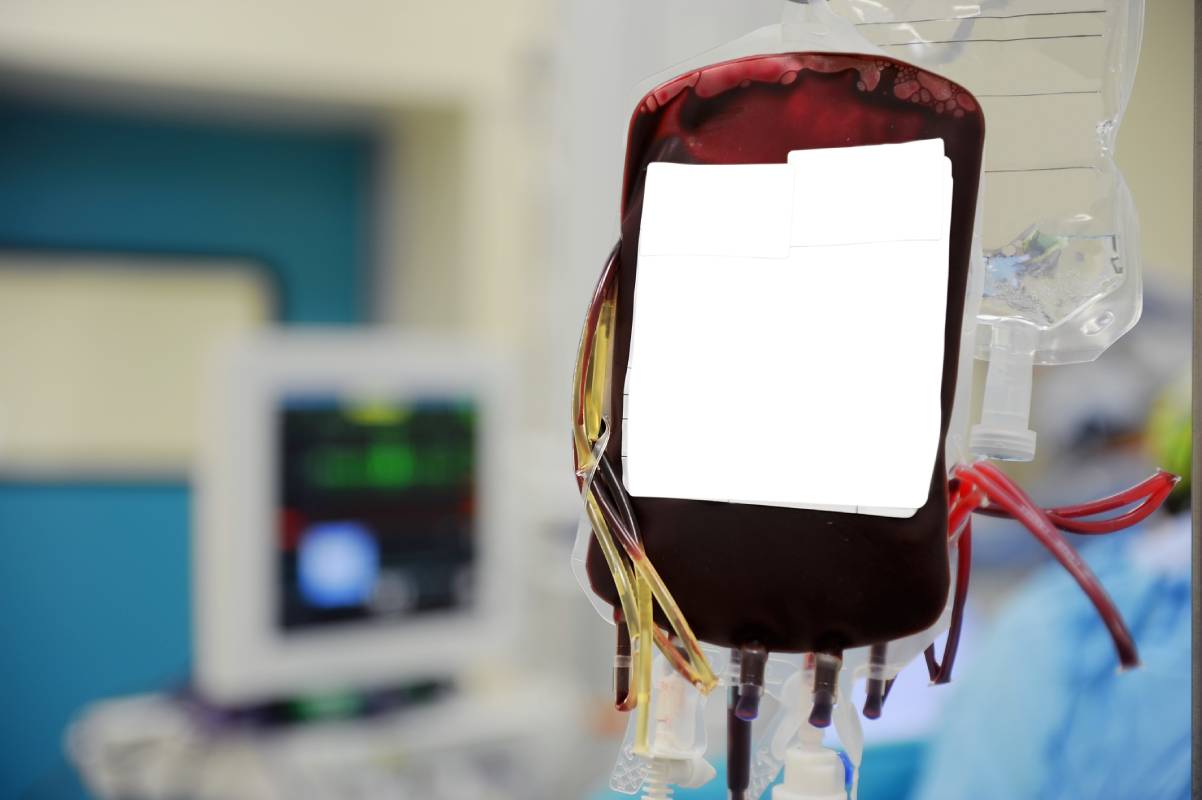 Blood Transfusions in the Operating Room