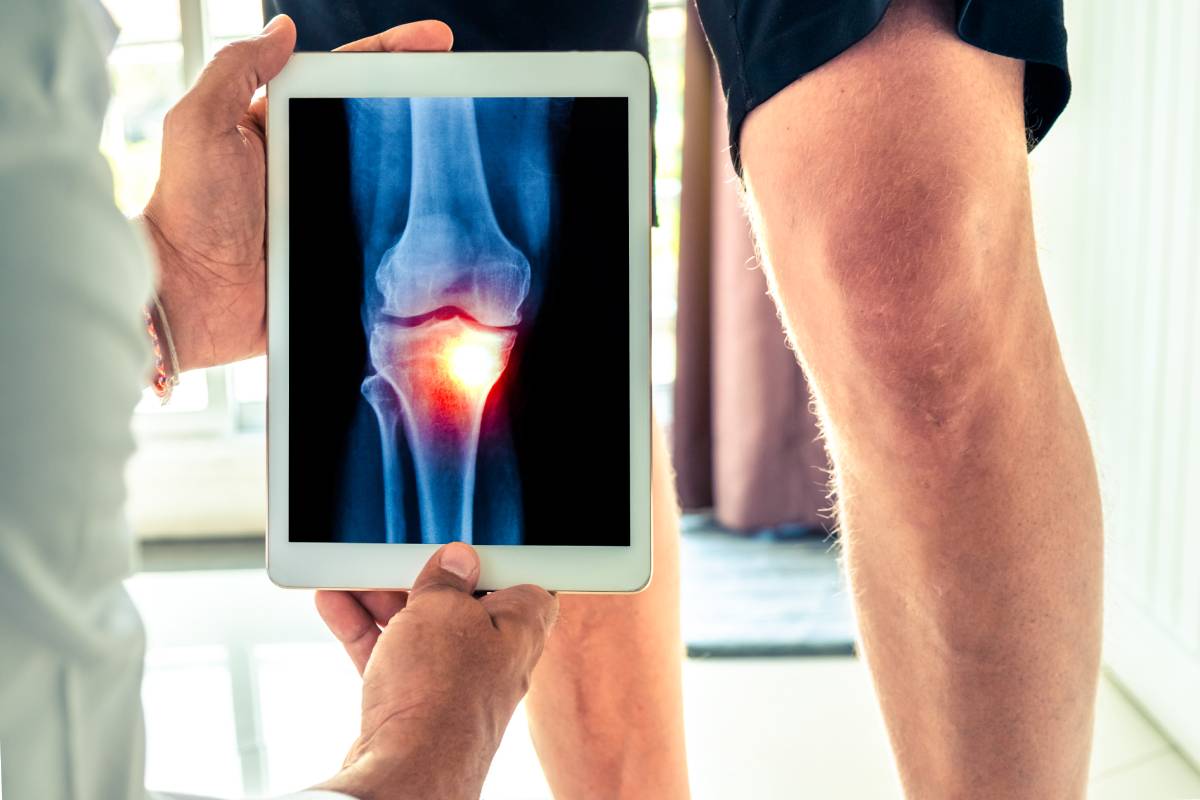 Adductor Canal Block for Total Knee Arthroplasty