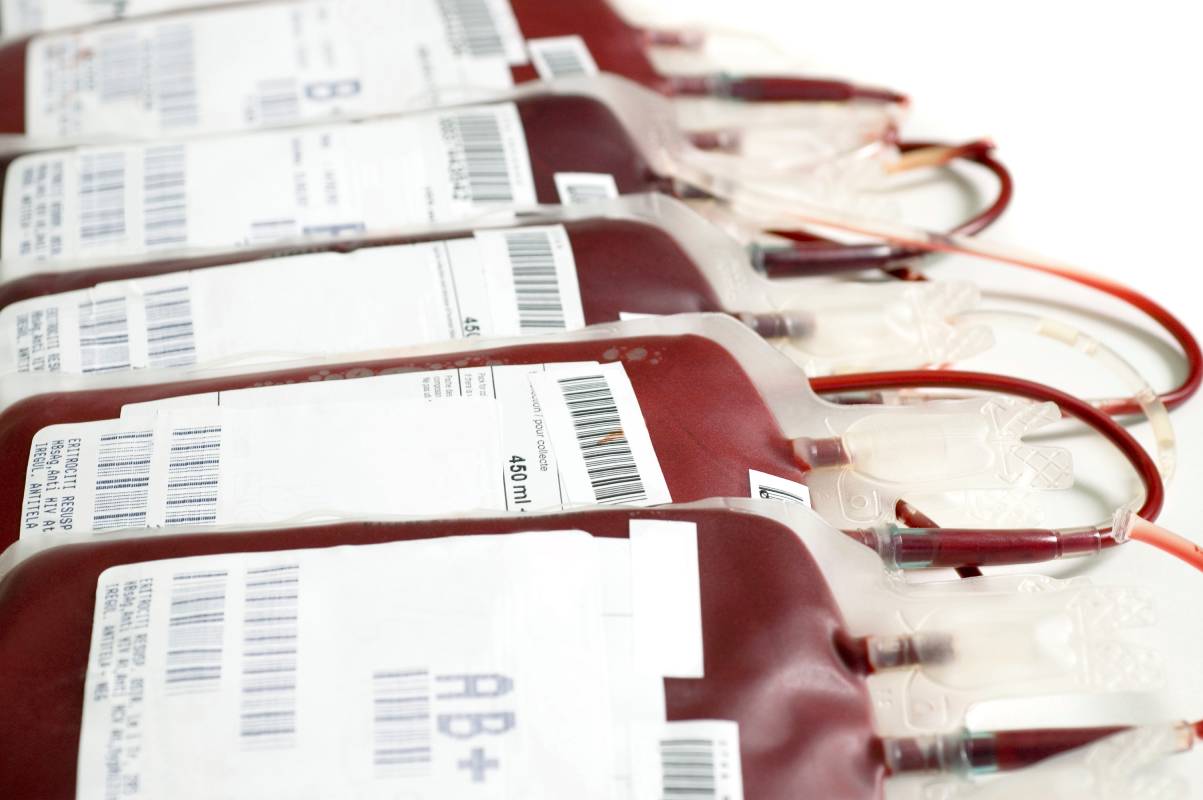 Adverse Effects of Blood Transfusions in Surgery 