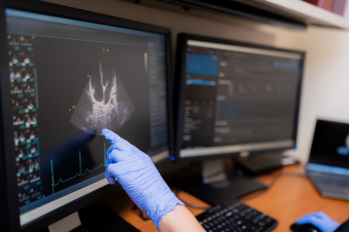 Computer-Aided Ultrasound for Neuraxial Anesthesia