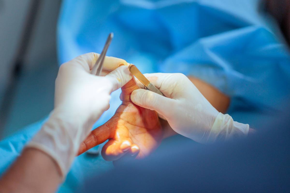 Hand Surgery in an Ambulatory Surgery Center (ASC)