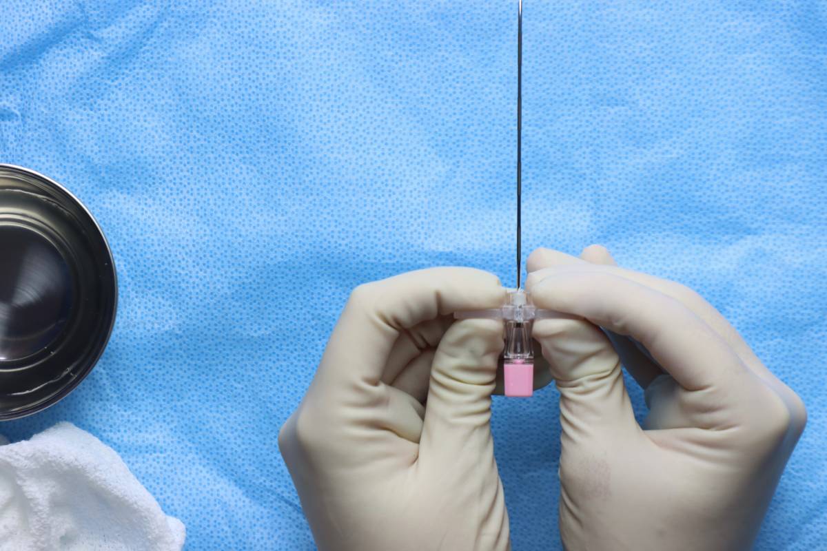 Use of Nerve Blocks in Gynecologic (GYN) Surgery