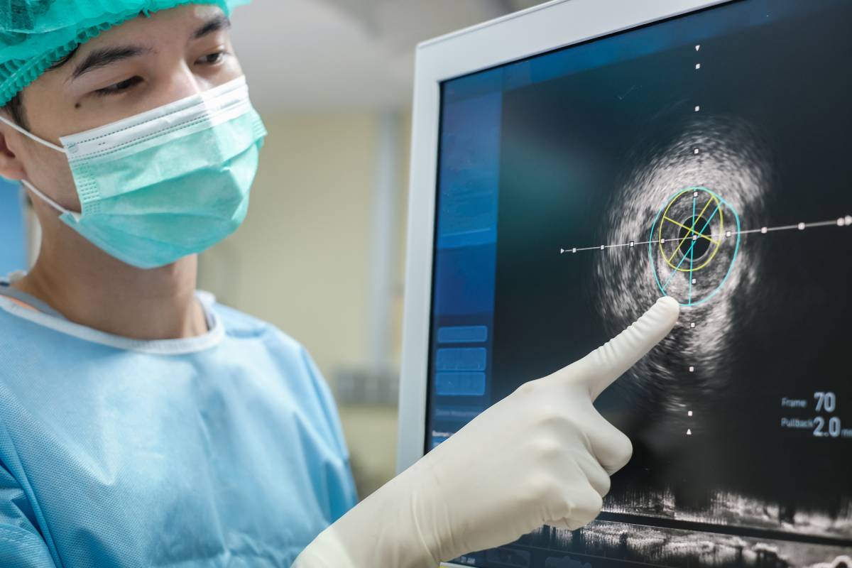 Pocket vs Full-Size Ultrasound in Anesthesia