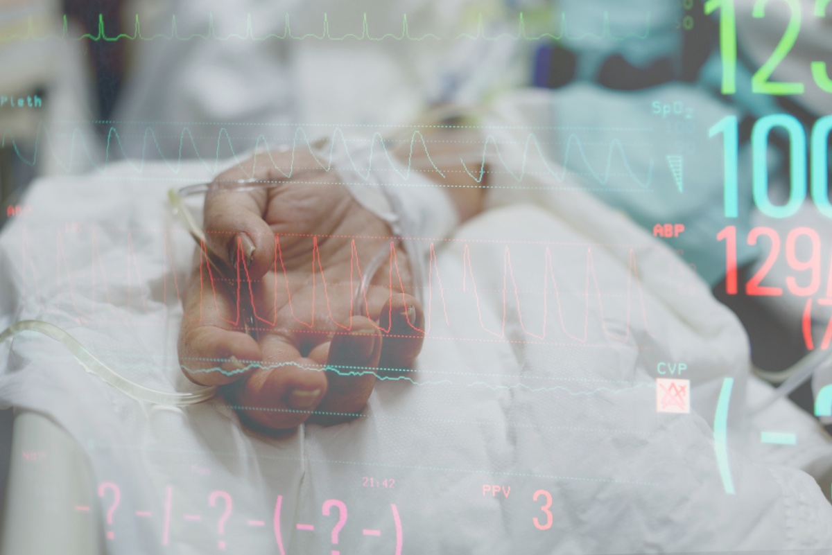 Arterial Blood Pressure Gradient Anesthesia Care
